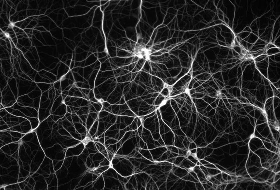 Wie duellierende neuronale Netze